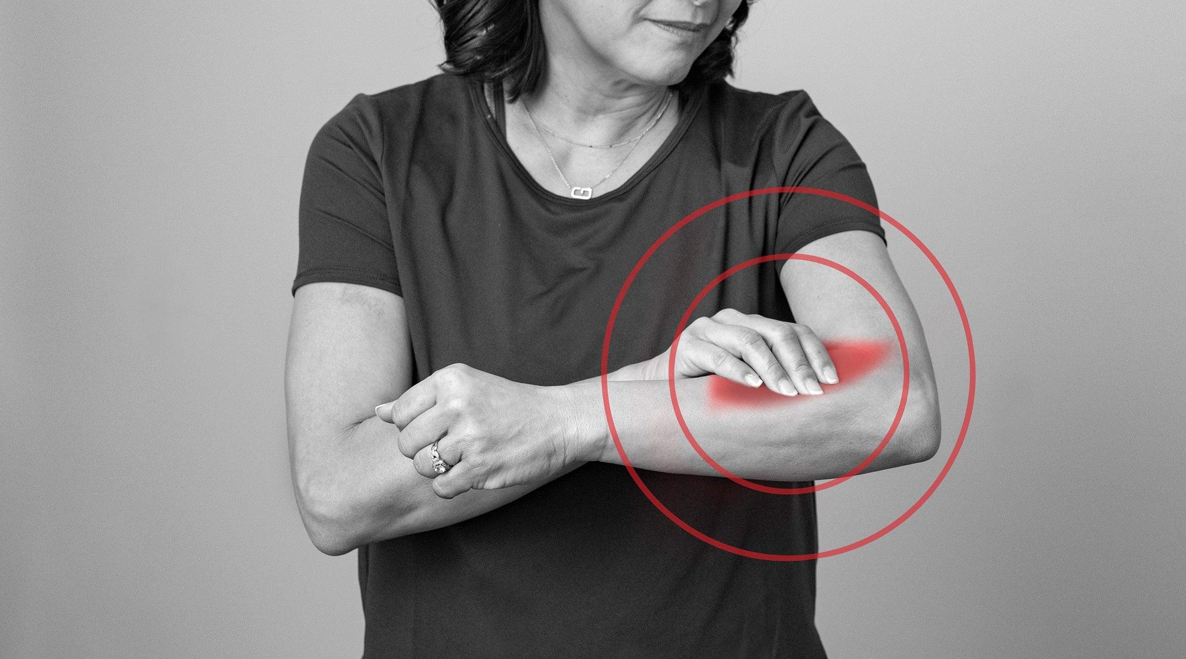 What is tennis elbow? - Fiix Body