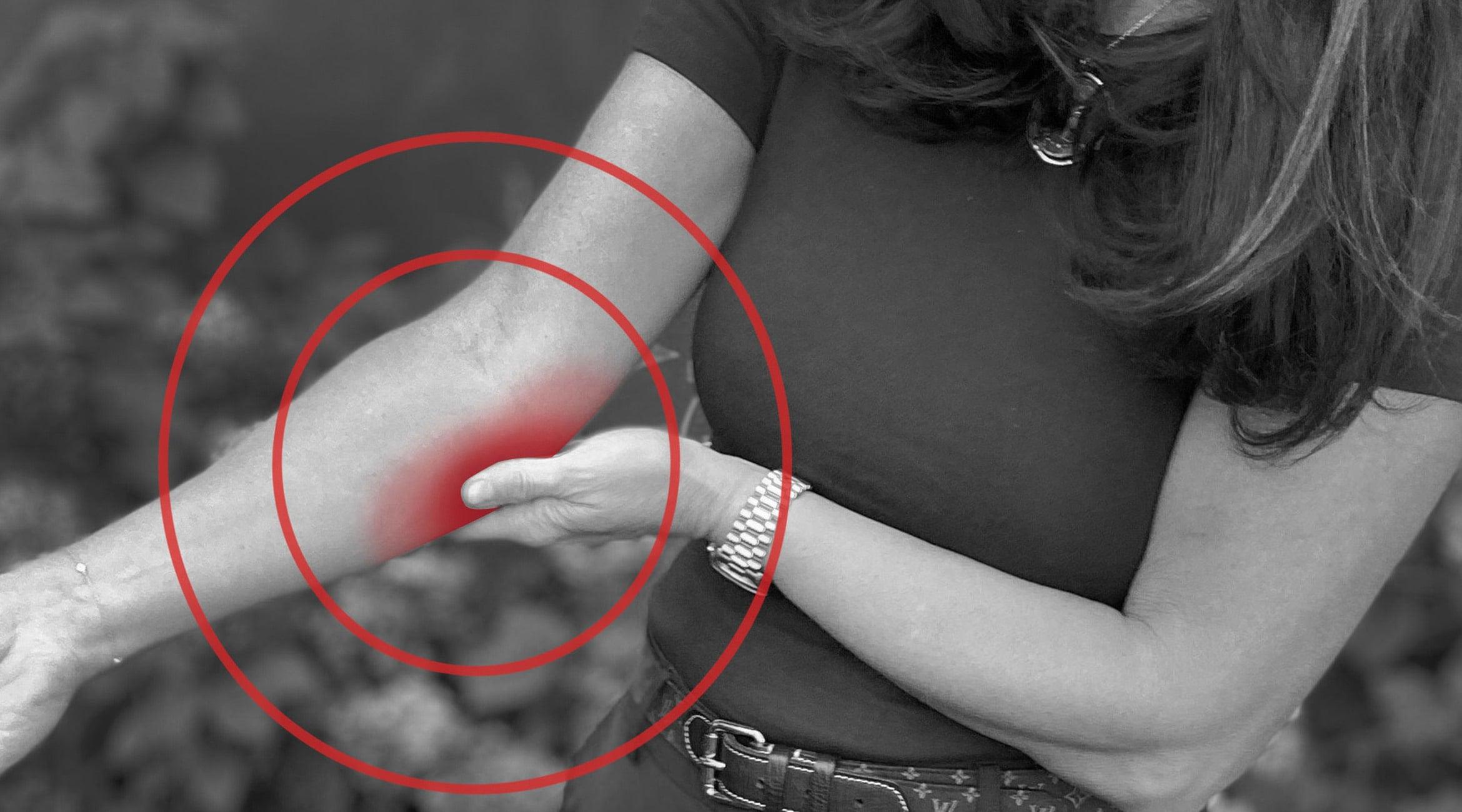 What's the difference between tendonitis and tendinosis? - Fiix Body