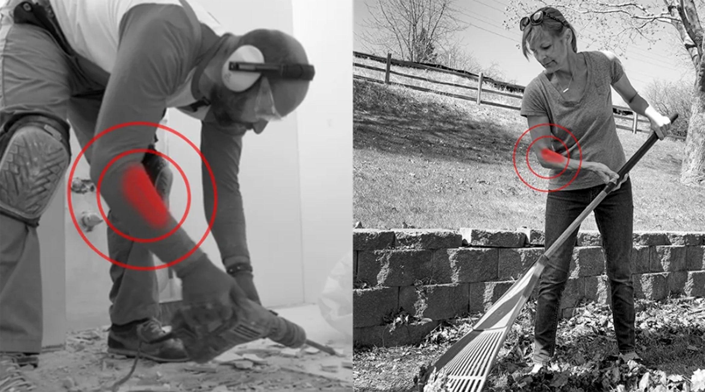 Why Repetitive Motion Causes Tennis Elbow in Jobs and Hobbies - Fiix Body