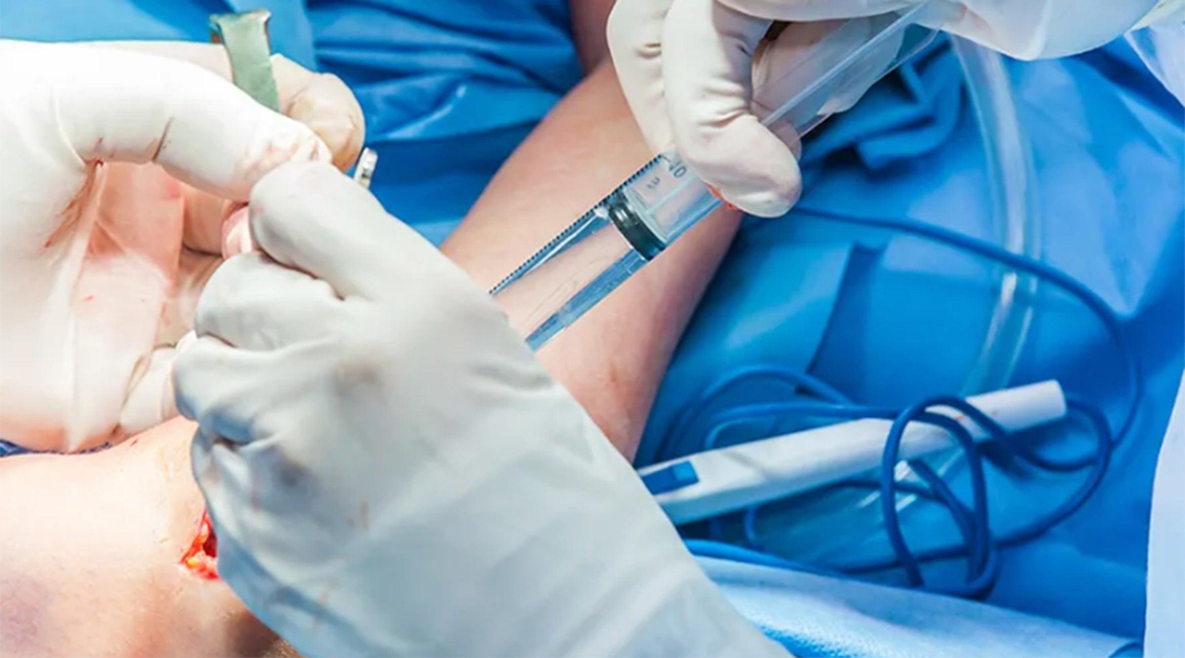 Should I get surgery for tennis elbow? - Fiix Body