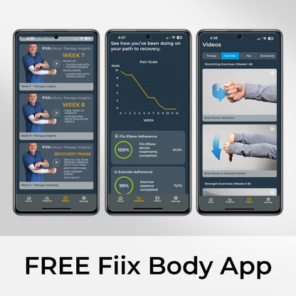 The Fiix Elbow