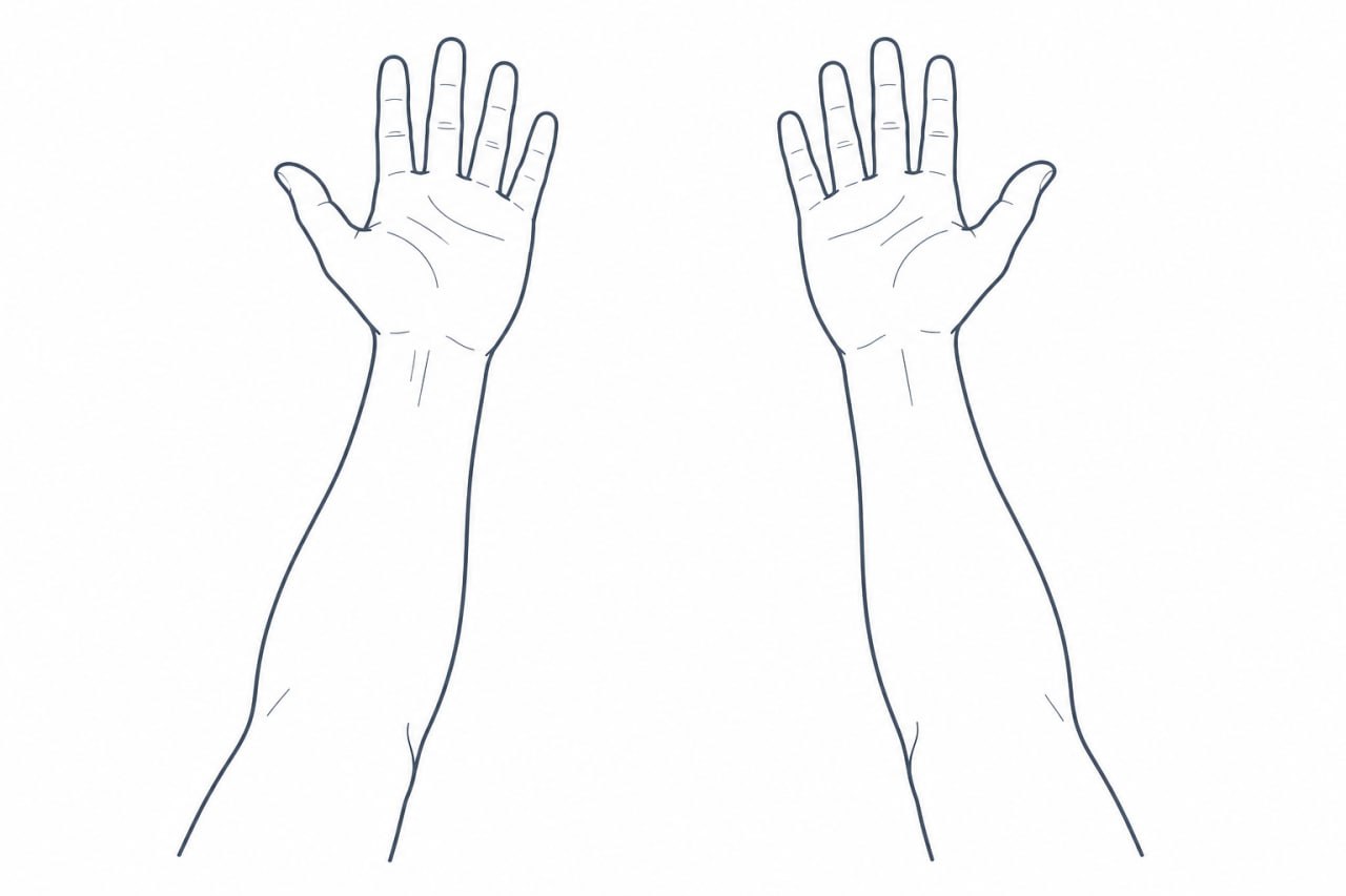 Palms-up view of both forearms for choosing elbow pain location